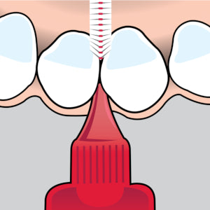 TePe Interdental Brush (Made in Sweden) - Free Postage Worldwide!